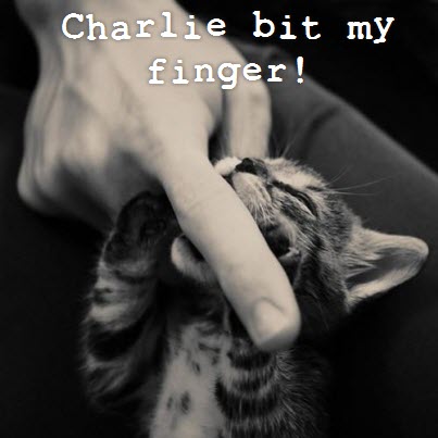 Charlie bit